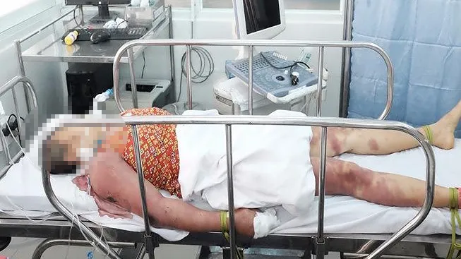 Làm lễ trừ tà, “pháp sư” đánh hai phụ nữ nhập viện