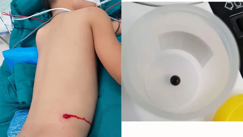 Các bác sĩ đang tiến hành phẫu thuật