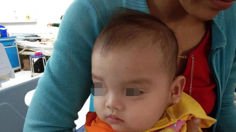 Đến nay, sức khỏe bé đã ổn định, bé được xuất viện với gương mặt lành lặn 