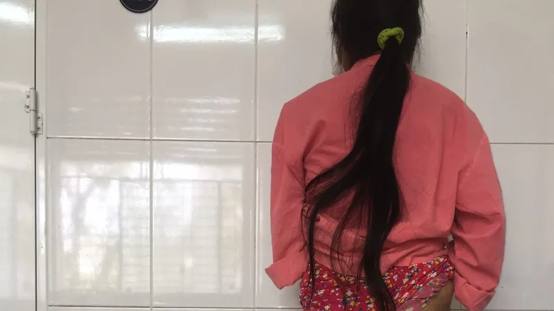 Một bệnh nhân bị U sợi thần kinh