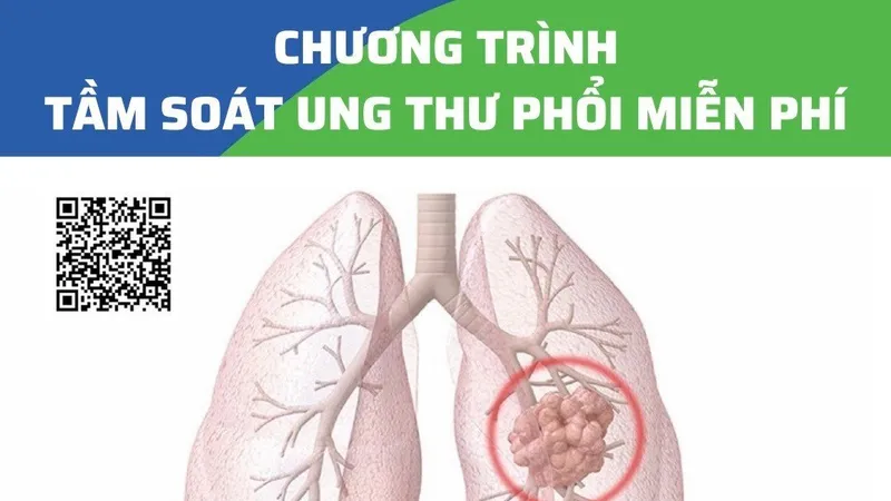Khám, tầm soát ung thư phổi miễn phí 