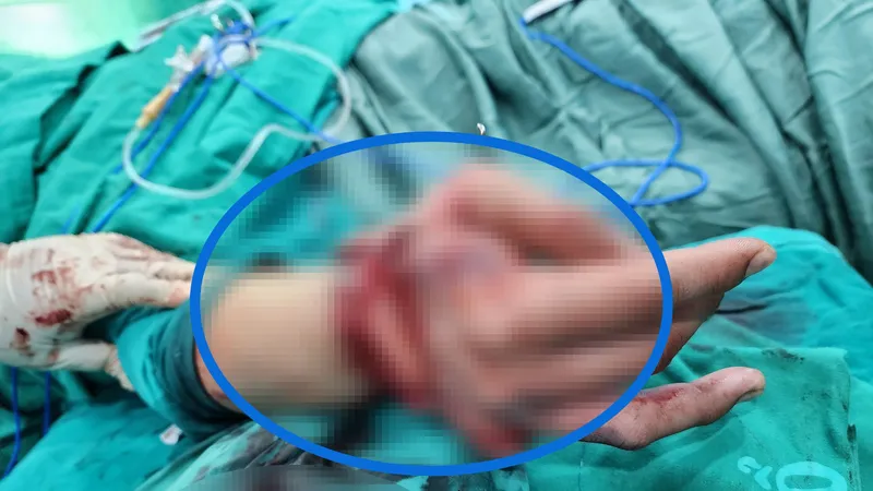 Bác sĩ đang thăm khám cho bệnh nhân sau phẫu thuật vi phẫu nối bàn tay đứt lìa