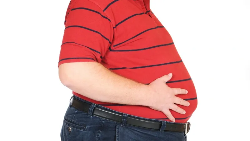 Việt Nam là quốc gia có tỷ lệ béo phì tăng nhanh nhất Đông Nam Á