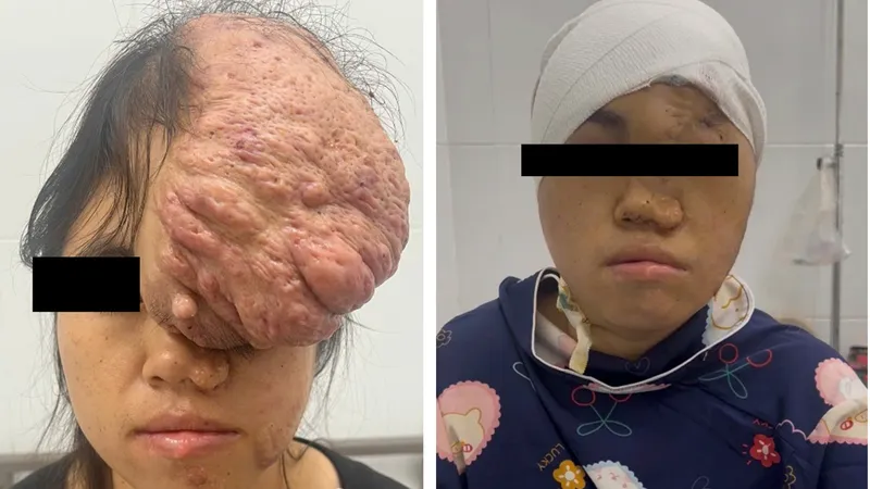 Người bệnh trước và sau phẫu thuật