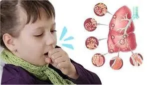 TPHCM ghi nhận một trường hợp mắc ho gà ở phường Tân Sơn