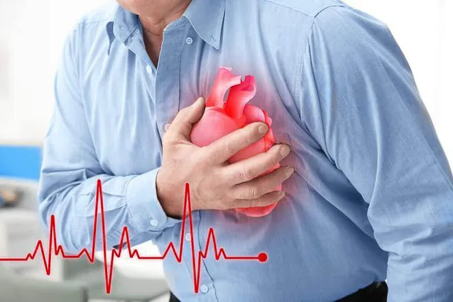 Gần 18 triệu người tử vong do bệnh lý tim mạch mỗi năm
