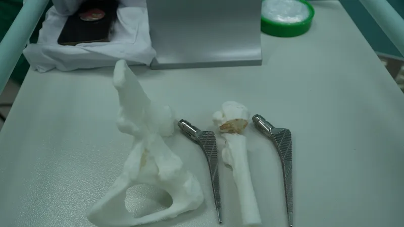 Ứng dụng in 3D in ra một mô hình nhựa với kích thước tương ứng với xương chậu và đầu trên xương đùi của chính người bệnh
