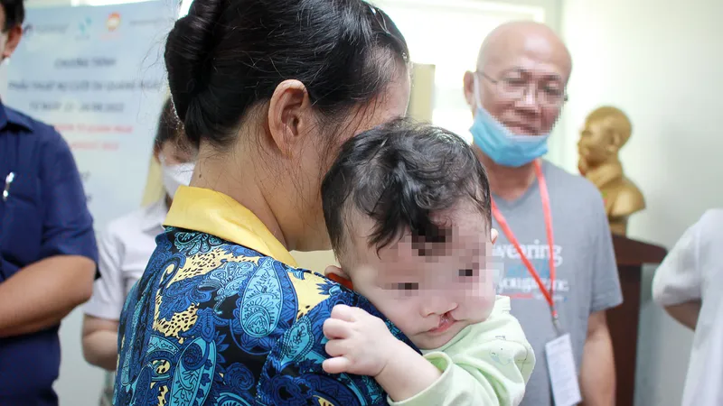 Trẻ bị dị tật đến khám tại chương trình. Ảnh: NGUYỄN TRANG