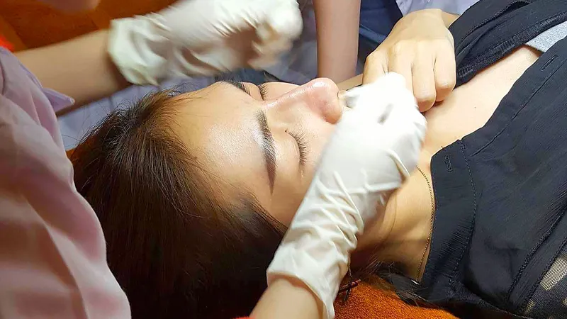 Một phụ nữ đang nâng mũi tại một spa kém chất lượng