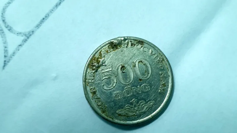 Gắp thành công đồng xu trong người bé gái 6 tuổi