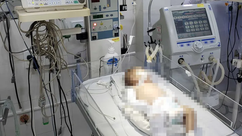 Bé sơ sinh 2 tháng tuổi nghi bị bạo hành nhập viện trong tình trạng nguy kịch