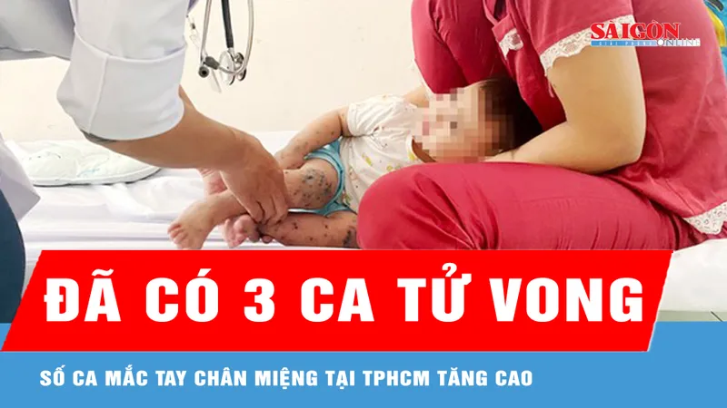 Số ca mắc tay chân miệng tại TPHCM tăng cao, đã có 3 ca tử vong
