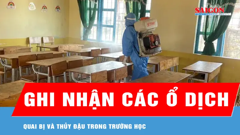 Đắk Lắk: Ghi nhận các ổ dịch quai bị và thủy đậu trong trường học 