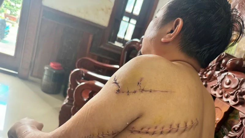 Truy tố 4 bị can vụ truy sát ông Nguyễn Khắc Tuấn