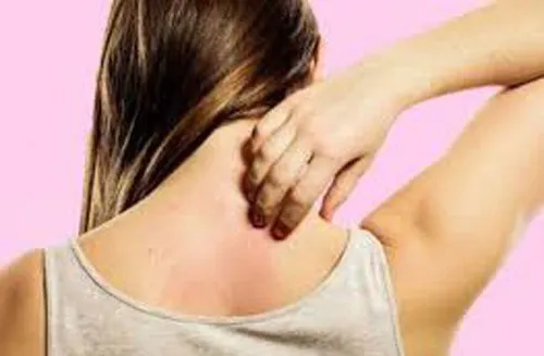 Bảo vệ sức khỏe trong mùa mưa