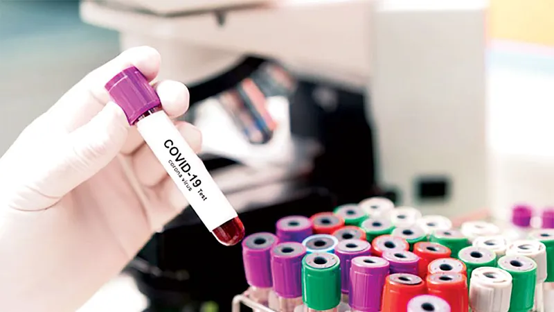 Cảm biến phát hiện SARS-CoV-2 trong không khí