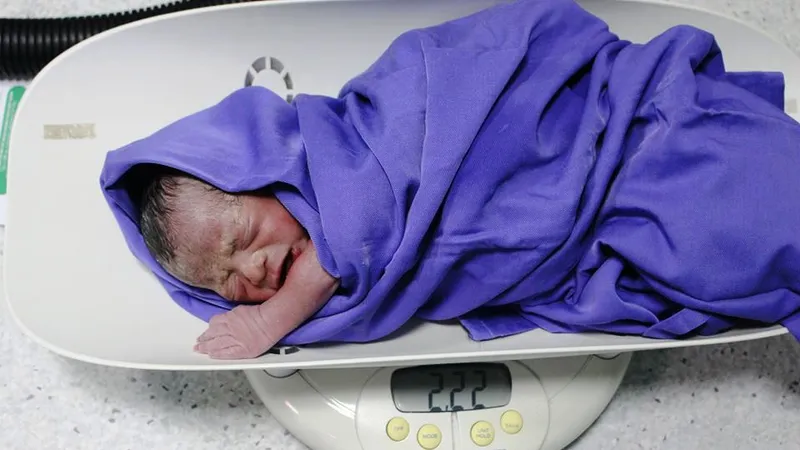 Con của sản phụ Đ.Th.L. sau ca mổ