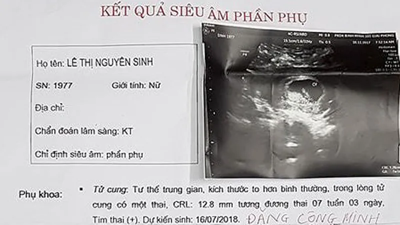 Làm rõ vụ bác sĩ Bệnh viện Bạch Mai mổ triệt sản bệnh nhân vẫn “dính” bầu