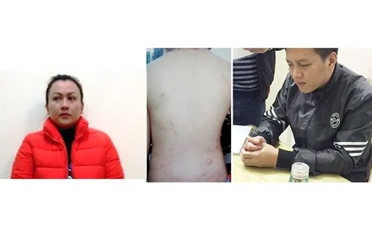 Bố đẻ - mẹ kế đánh đập dã man con trai sắp hầu tòa