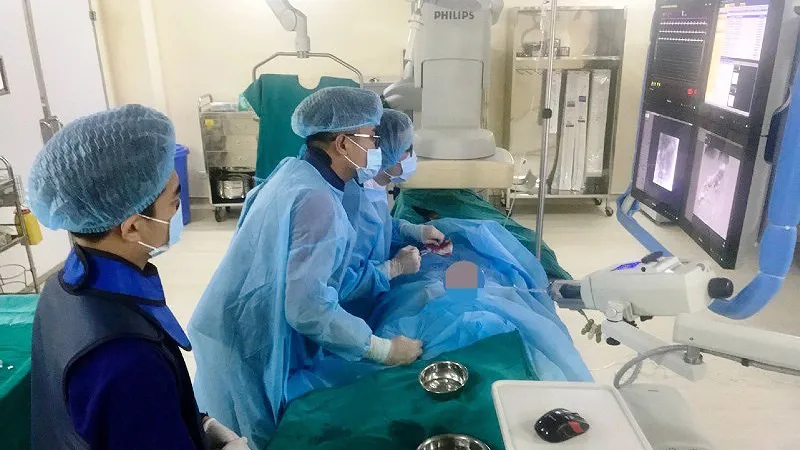 Đốt u gan bằng vi sóng 