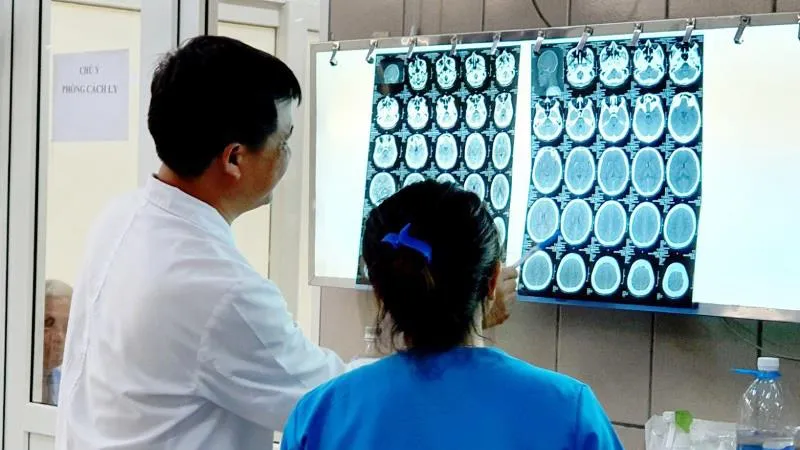 “Đập đá” thanh niên 27 tuổi ngộ độc, xuất huyết não 