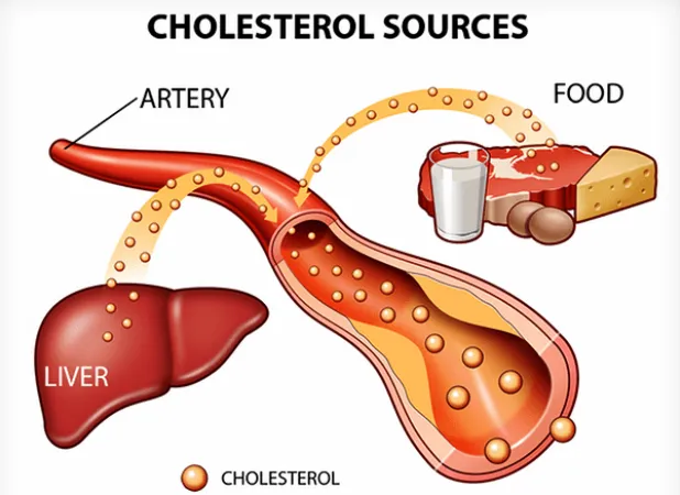 Báo động tình trạng người Việt Nam bị thừa Cholesterol 