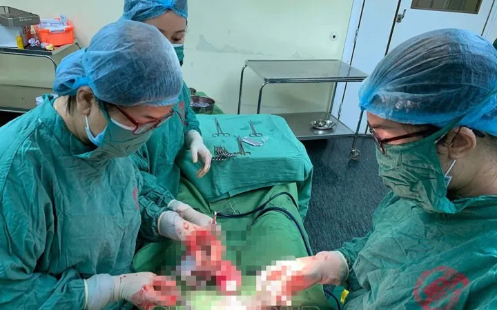 Cực hiếm gặp sản phụ mang thai đôi ở 2 tử cung khác nhau được mổ đẻ thành công