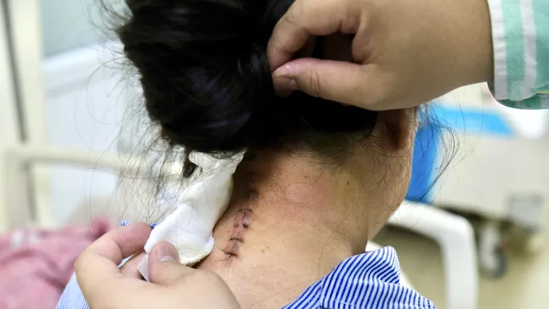 Nữ bệnh nhân 2 lần bị ung thư được phẫu thuật thành công