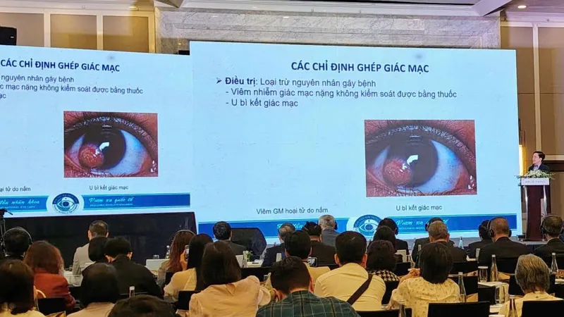 Giác mạc sinh học mở hy vọng mới cho người mù lòa