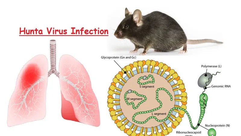 Việt Nam chưa ghi nhận ca mắc virus Hanta