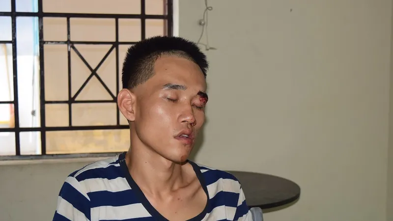 Khởi tố đối tượng cứa cổ người đàn ông đi viếng tang