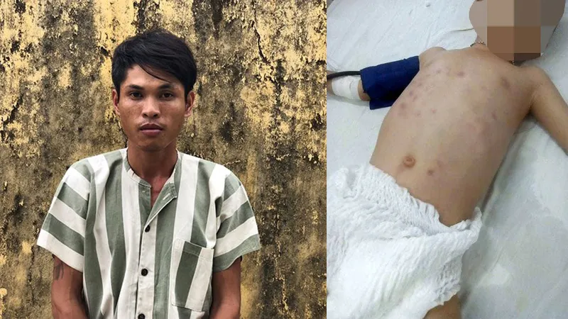 Bắt đối tượng đánh đập con riêng người tình đến vỡ ổ bụng