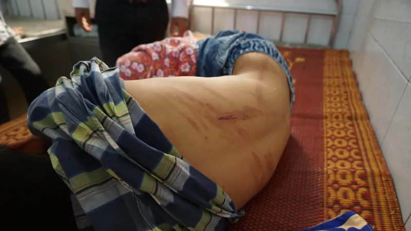 Em Nguyễn H. L. với nhiều vết thương đang nằm điều trị tại bệnh viện 
