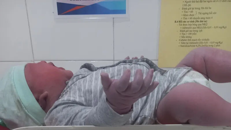 Các y bác sĩ Trung tâm Y tế huyện Hương Sơn đã mổ đẻ thành công, đón bé sơ sinh cân nặng 6kg