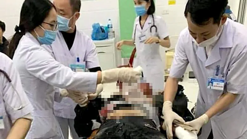 Nhiều nạn nhân nhập viện do sử dụng pháo nổ