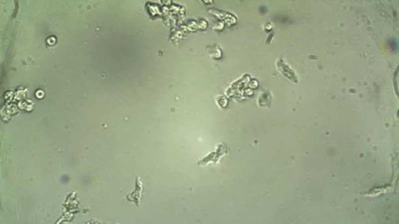 Đã điều chế thành công vaccine tái tổ hợp có khả năng tăng cường hệ miễn dịch đối với đơn bào Entomoeba histolytica, tác nhân gây bệnh do amip 