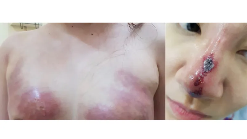 Làm đẹp đón tết: Coi chừng rước họa