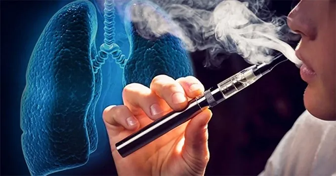 Sớm quyết định pháp lý với thuốc lá điện tử