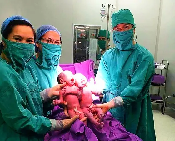 Các bác sĩ Bệnh viện Sản Nhi Quảng Ninh đón 2 trẻ sinh đôi bằng phương pháp thụ tinh trong ống nghiệm
