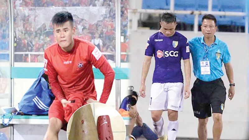 Tiền vệ Anh Hùng (trái) rất đau đớn sau pha “triệt hạ” của Sầm Ngọc Đức. Ảnh: CTV
