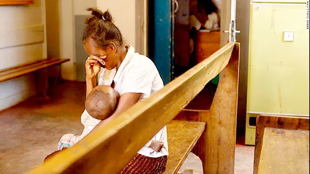 Hàng trăm trẻ chết ở Madagascar vì thiếu vaccine