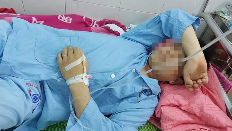Anh Vũ Văn Pho điều trị ở bệnh viện sau khi bị đánh. Ảnh: Thanh Nien Online