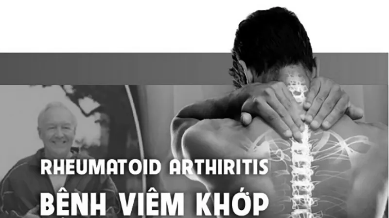 Tặng sách hỗ trợ điều trị xương khớp tại nhà