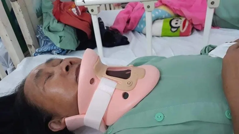 Chị Thanh bị gãy cột sống cổ