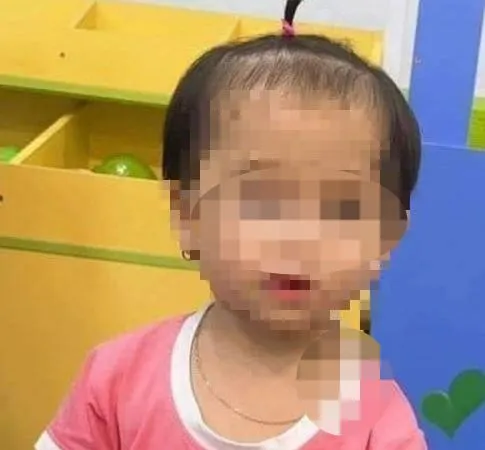 Bé C. trước khi tử vong