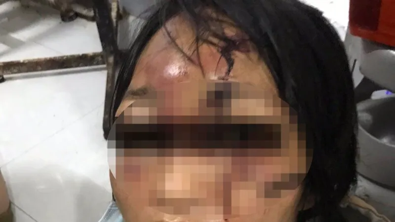 Bắt đối tượng đánh đập dã man người tình cùng con gái 