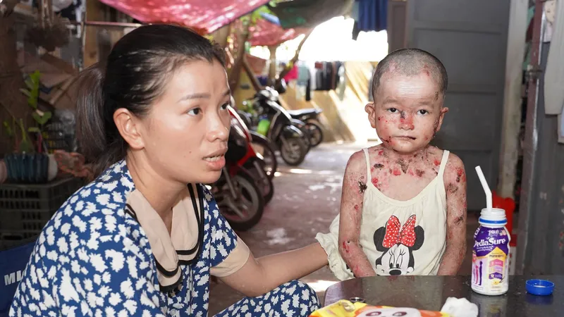 Bé Hứa Ngọc Linh và chị Trương Thị Lan Hương