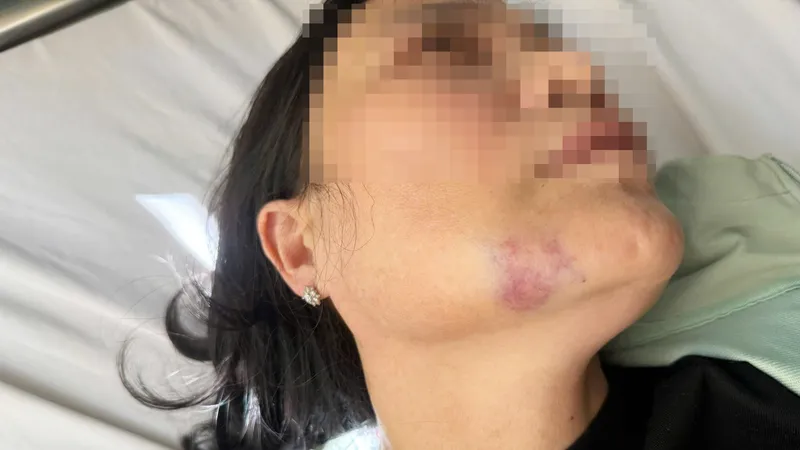 Bà T. bị thương, vẫn đang điều trị