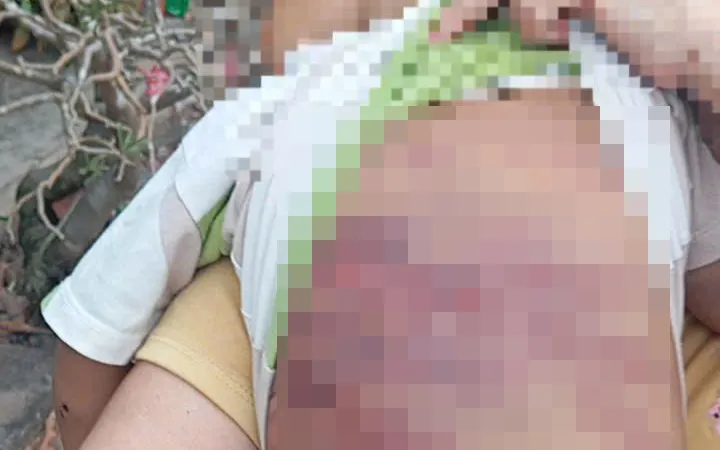 Thêm cuộc gọi, giảm nỗi đau với trẻ bị bạo hành
