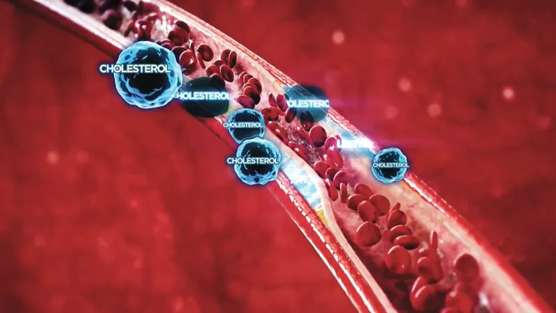 Kiểm soát cholesterol tốt, giảm 27% nguy cơ đột quỵ